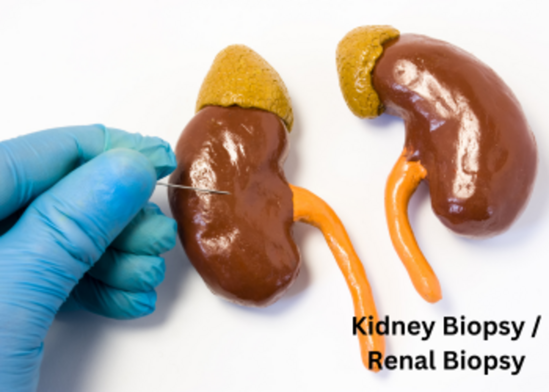 Renal biopsy(Usg guided)